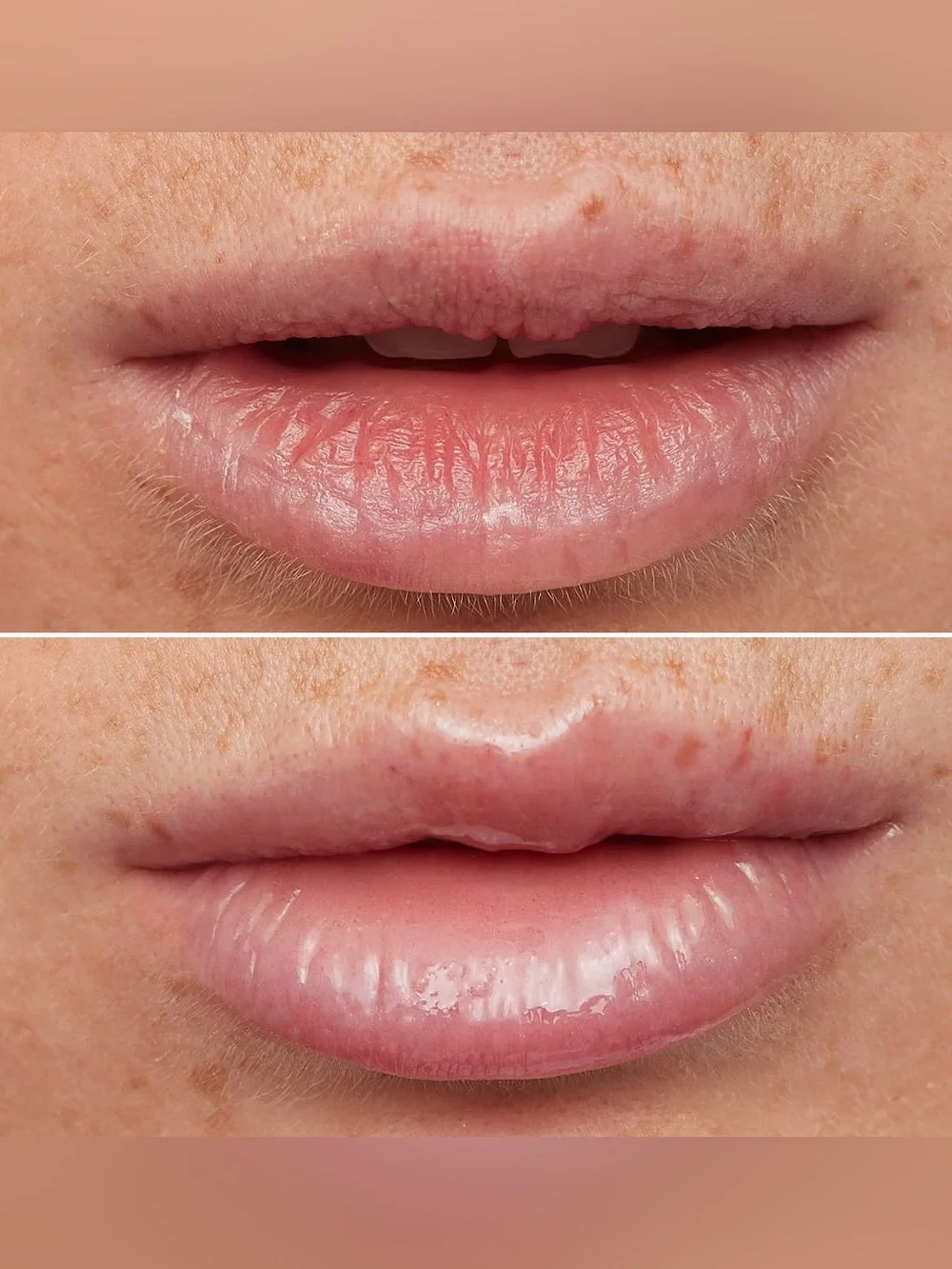 Wonderskin LIP Rehab Serum Oil - Clear NIB